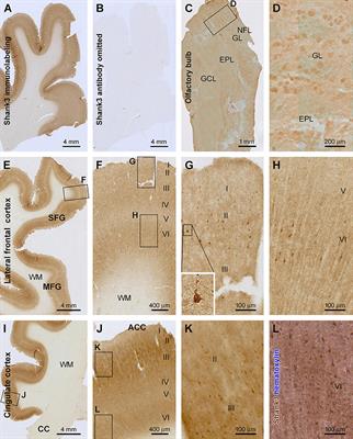 Expression of the Excitatory Postsynaptic Scaffolding Protein, Shank3, in Human Brain: Effect of Age and Alzheimer’s Disease